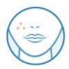 Caused when redundant skin cells and oil from the skin clog hair follicles. Teen, adults.