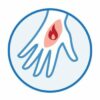 Corneotherapy can help to reduce the visual effect.